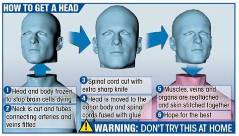human head transplant results